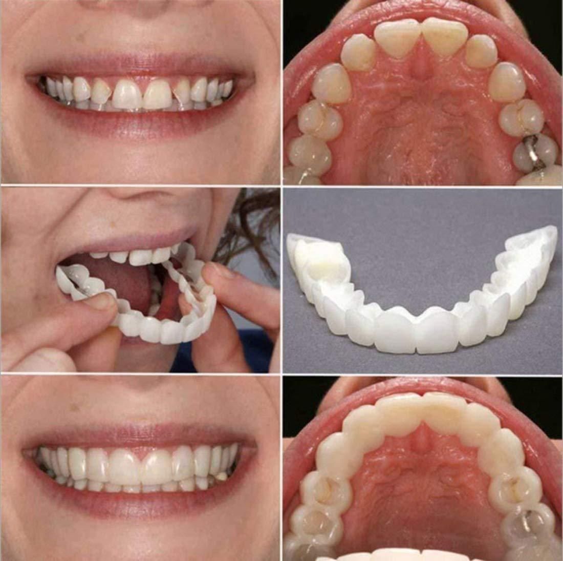 Transform your smile instantly and affordably!